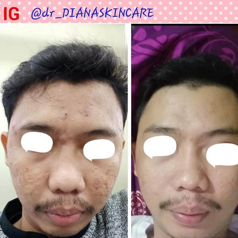Testimoni Customer 14
